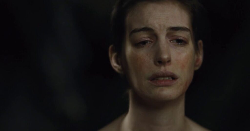 A preparação de Anne Hathaway em "Os Miseráveis". Foto: Reprodução.